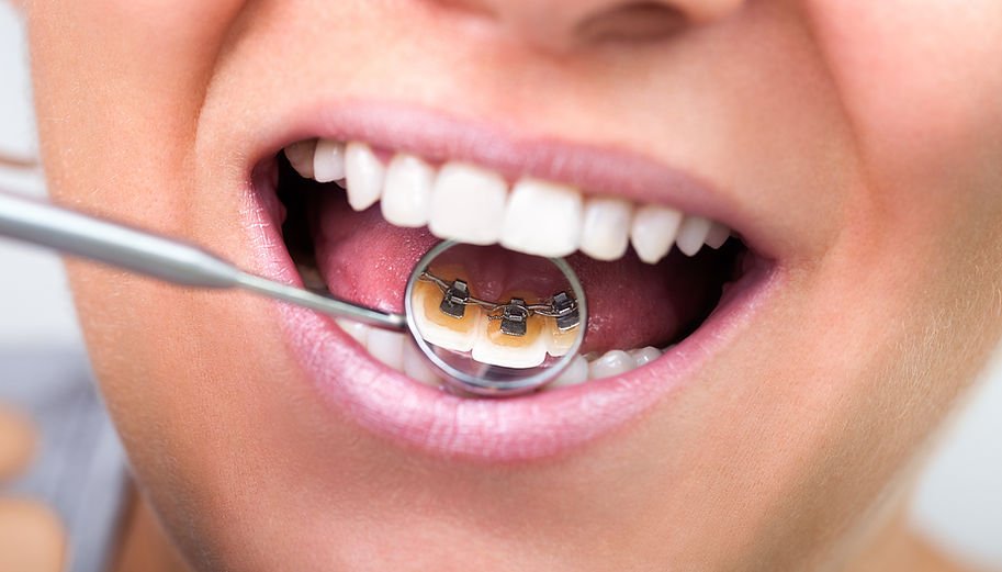 Evershine Dental: Google Ads — case-study supporting evidence